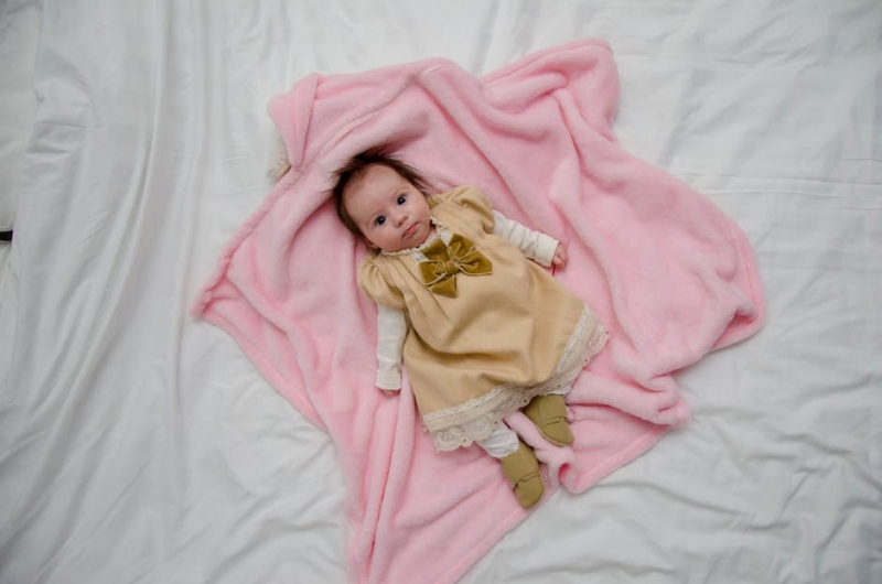 新生儿黄疸护理常识新生儿黄疸存在哪些症状